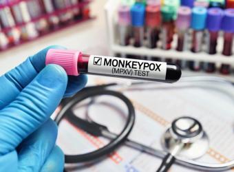 Monkeypox Virus